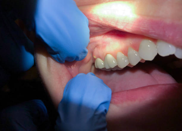 Best Mobile Emergency Dentist in Canton Valley, CT