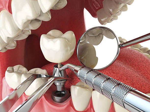 Best Pediatric Emergency Dentist in Canton Valley, CT